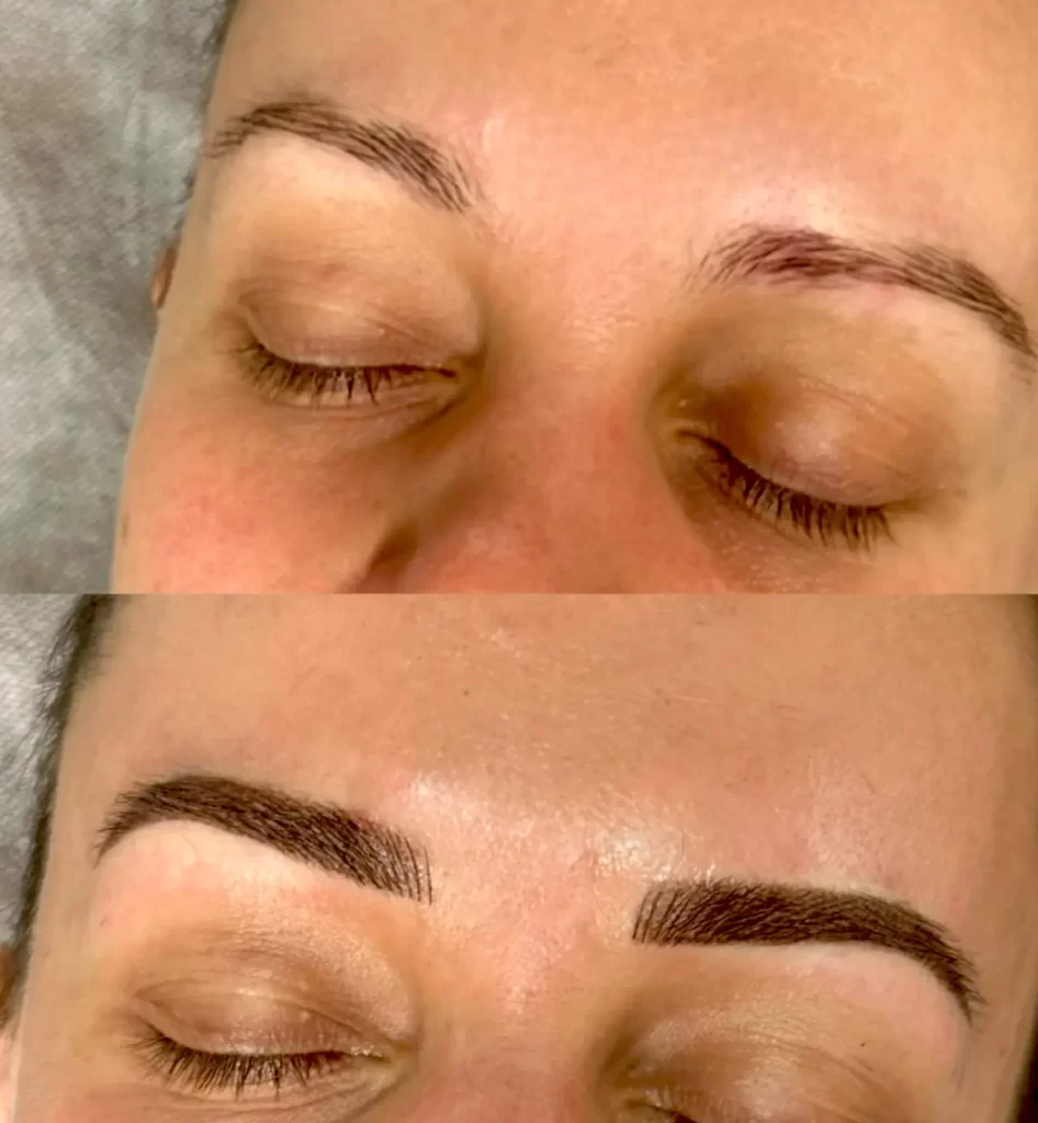 How Long Does It Take to Look Natural