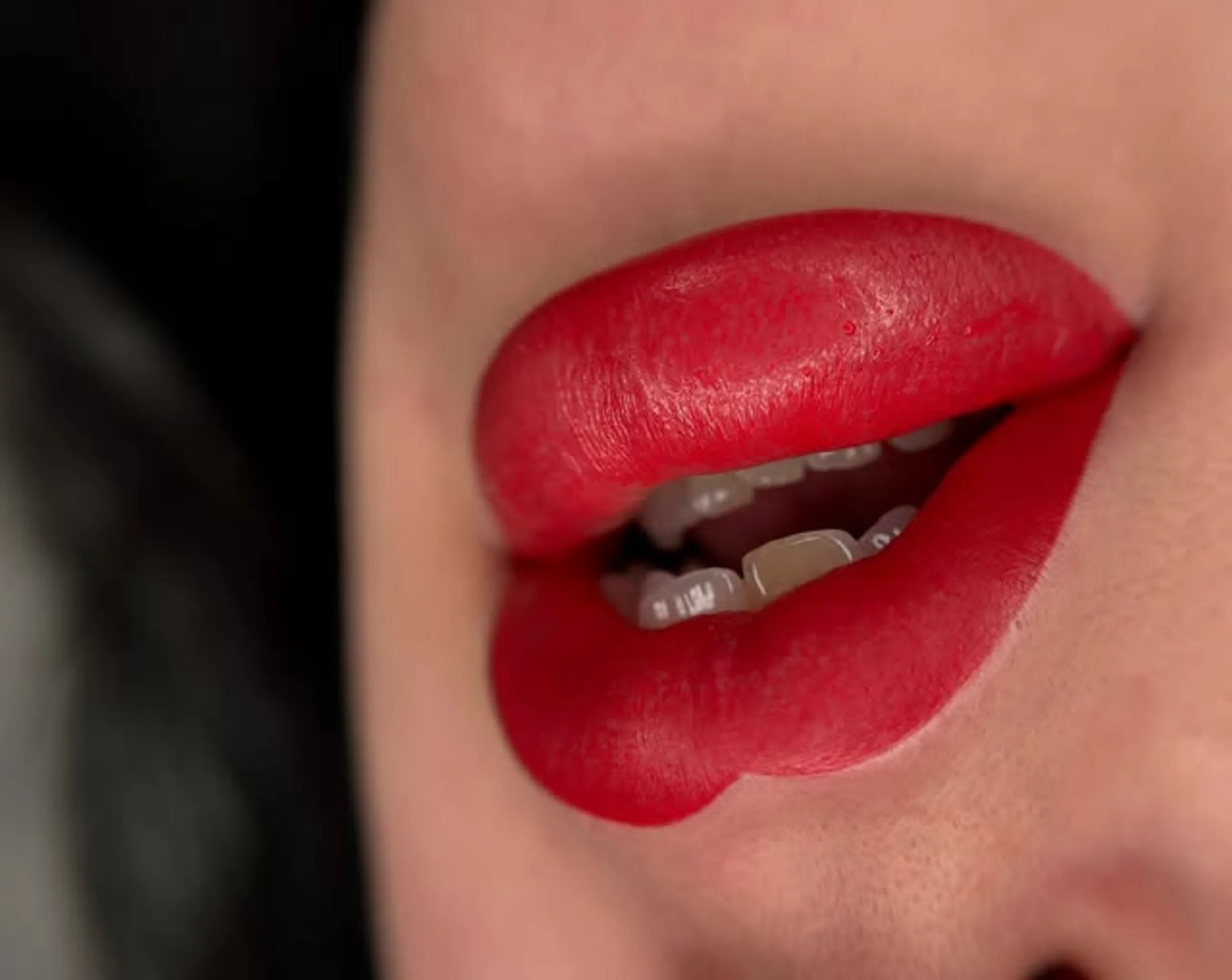 lip tattoo risks