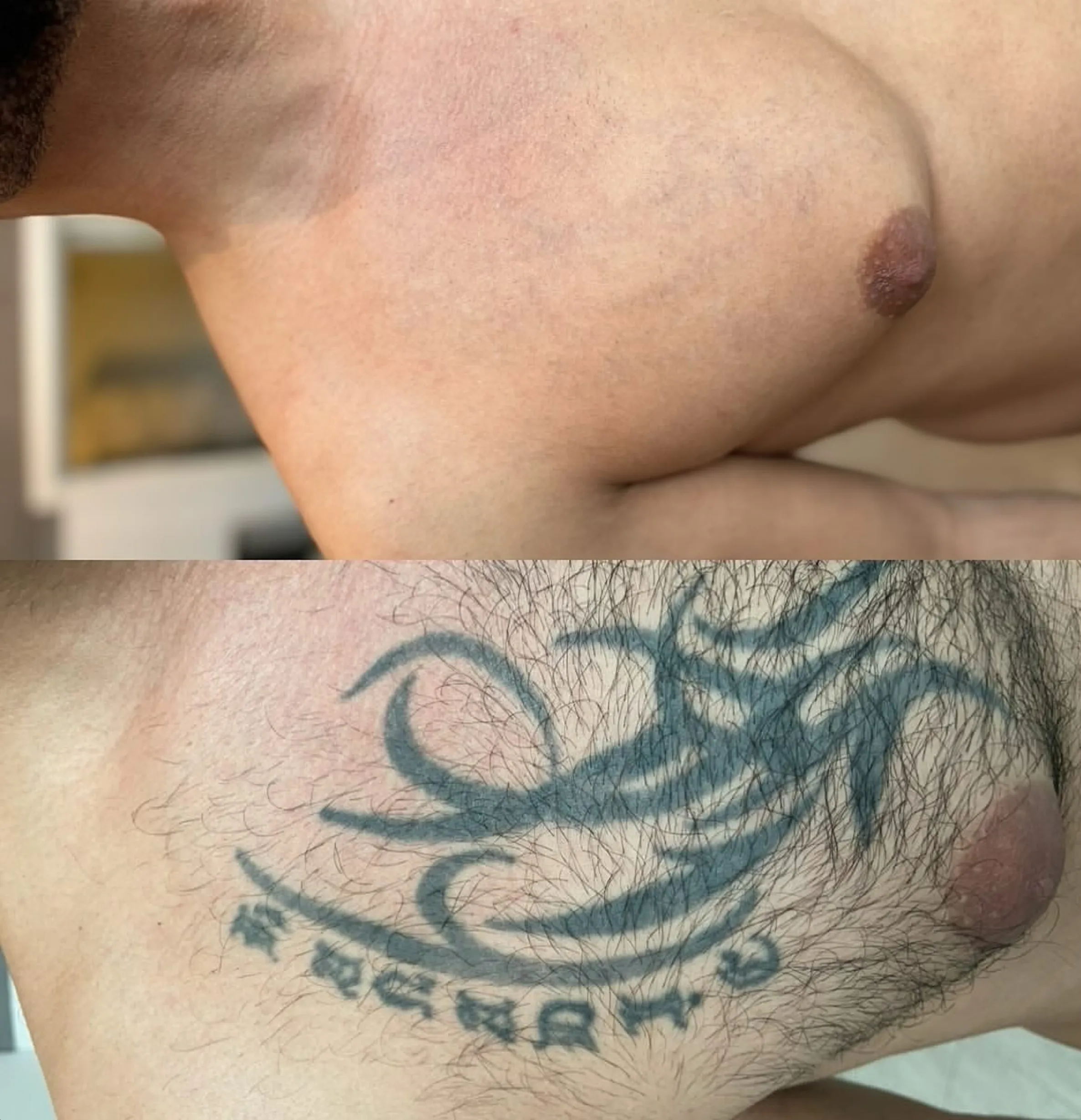 tattoo removal cream review